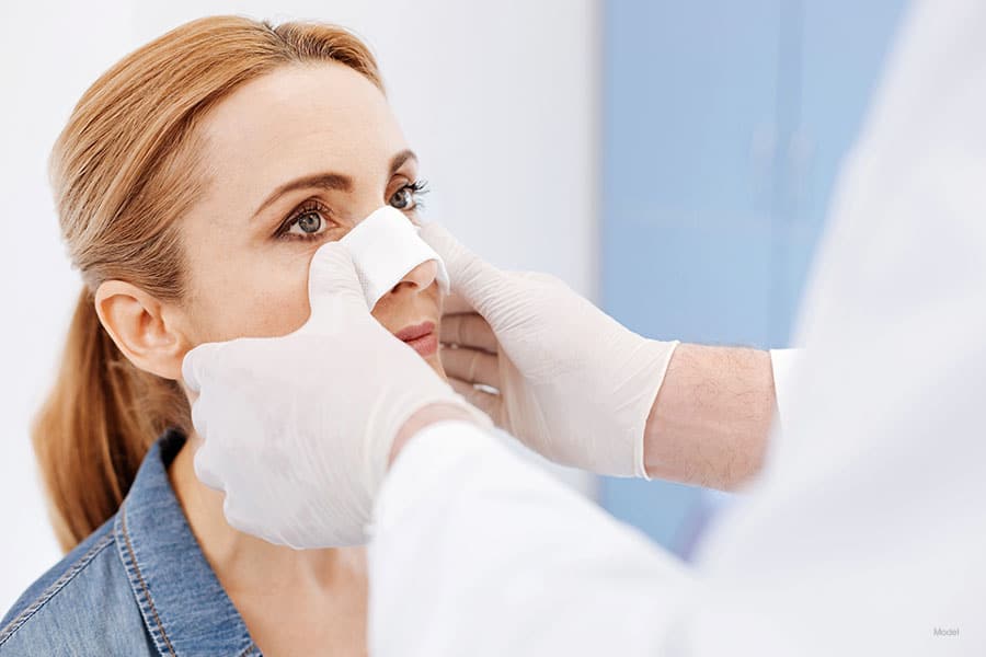 ¿Qué puedes esperar después de tu procedimiento de rinoplastia?